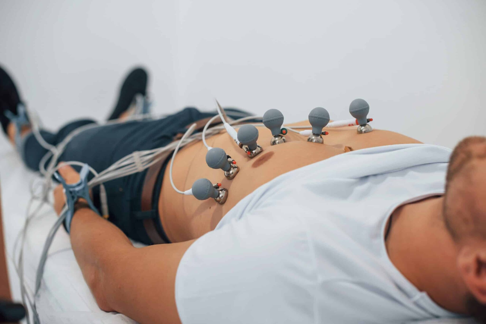 ECG